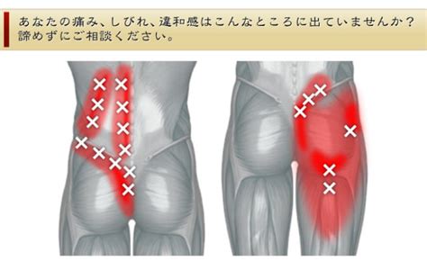 腰痛の種類別原因・筋肉によるもの｜加西市の整体は国家資格者20年の実績｜豊田接骨院。腰痛・骨盤矯正・自律神経症状の改善なら豊田接骨院