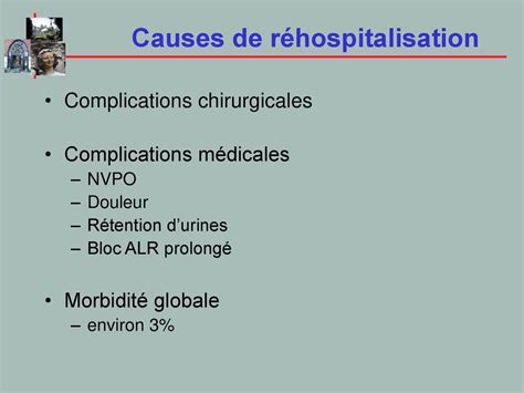 Contraintes De L’anesthésie Ambulatoire Ppt Télécharger