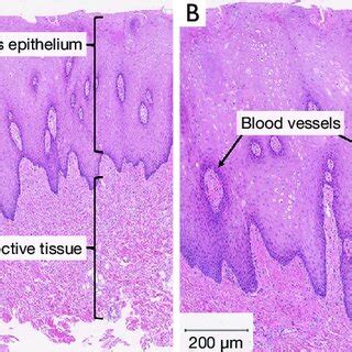 H E Stained Buccal Mucosa A Representative H E Section At 40