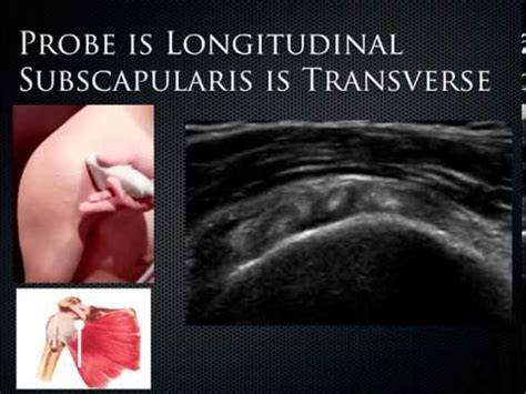 12 MSK Anatomical Ultrasound Of Shoulder Knee Hand YouTube