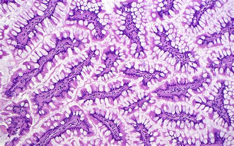 Small Intestine Light Micrograph Stock Image C057 1487 Science