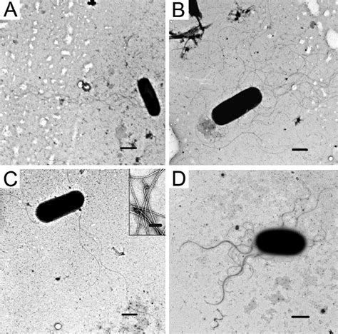 TEMs Of Negatively Stained C Botulinum Showing The Flagellation Of