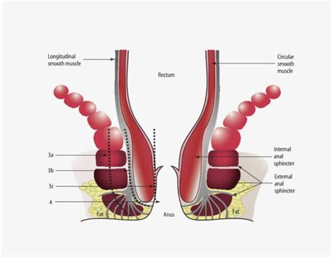 Botox Treatment For Anal Fissures Avrupa Cerrahi T P Merkezi