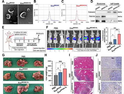 Gc Derived Exosomes Promote Liver Metastasis A Representative Images