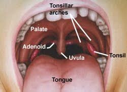 Free For Health: Tonsil Stones Removal