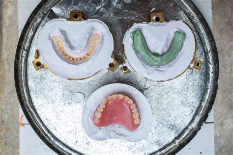 What Is The Process For Getting Dentures? - Arc Dental