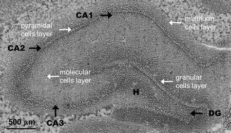 The microscopic view of the rat hippocampal formation showing the areas ... 