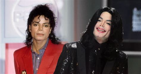 Michael Jackson was ‘insecure’ about skin condition that changed colour