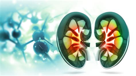 Overview of Kidney Transplantation - UW Medicine Provider Resource