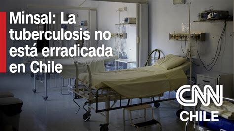 Casos de tuberculosis en Chile Ministerio de Salud recalcó que no está