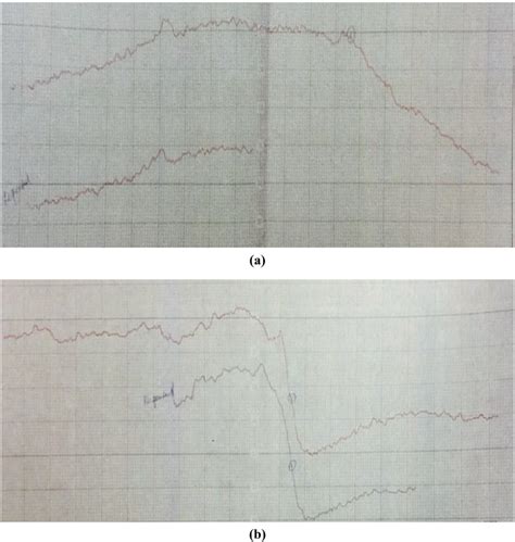 Electronic Paramagnetic Resonance EPR Spectral Curve For A Co II