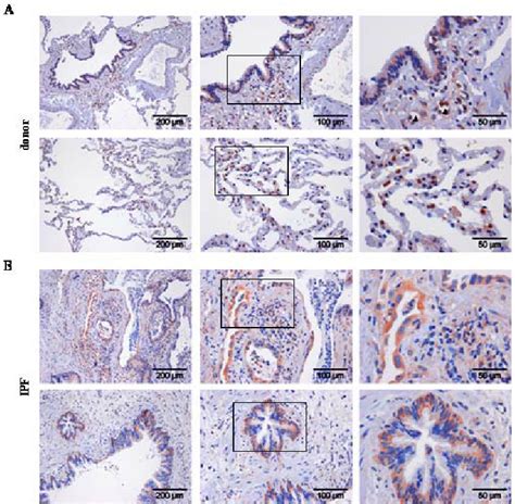 Expression And Localization Of Total Gsk 3 B In Lung Tissues Of Donor Download Scientific