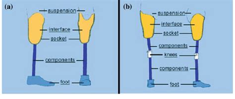 A Trans Tibial Below Knee Prosthesis With Components Part B Download Scientific Diagram