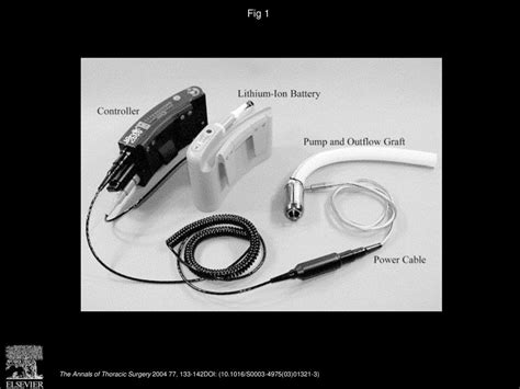 Clinical Experience With An Implantable Intracardiac Continuous Flow