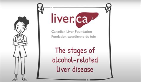 The Different Stages of Alcohol-Related Liver Disease - Canadian Liver ...