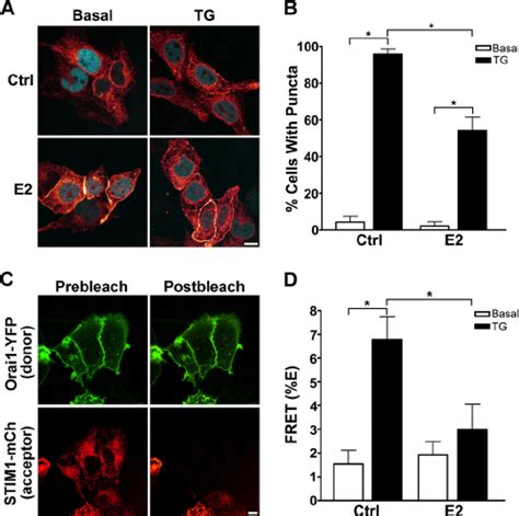 E2 Inhibits STIM1 Aggregation And Redistribution A Typical Images Of