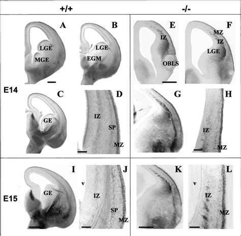 Expression Of Psa Ncam In Wild Type A D I And J And Pax Mutant