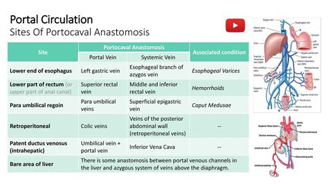 Portacaval Anastomosis