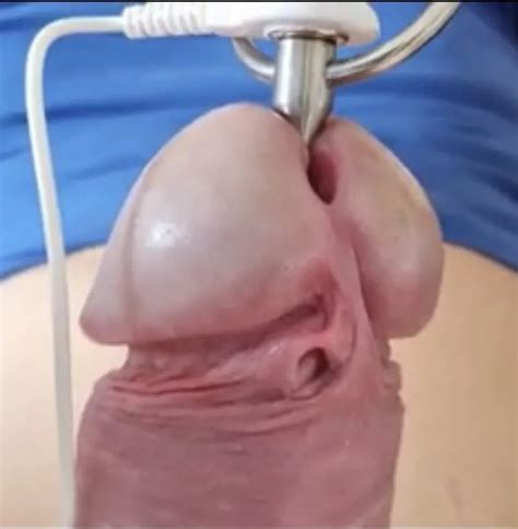 Urethral Estim Close Up Nude Pics Xhamster