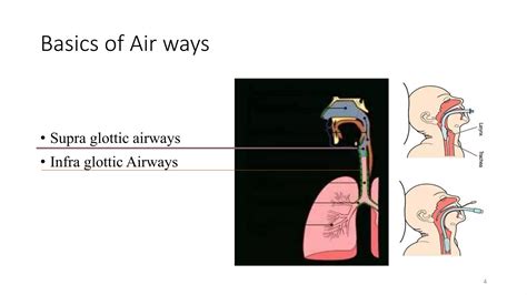 Supraglottic Airway Devices Pptx