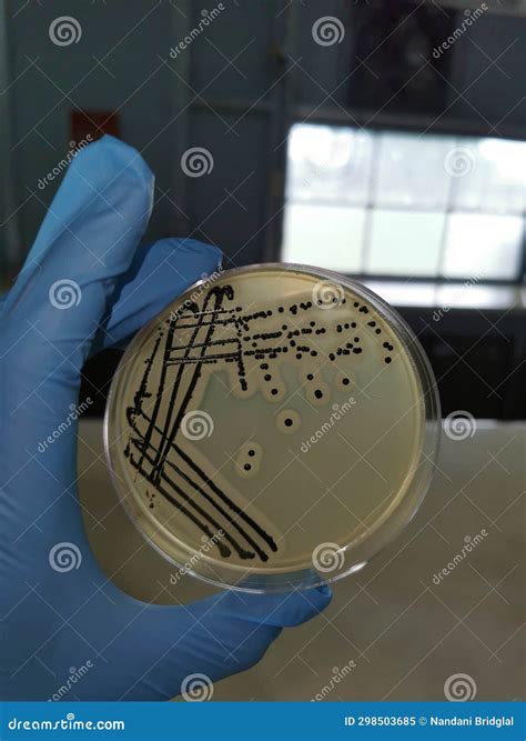 Contamination Of An Inoculated Mycelium Substrate At A Mushroom Farm