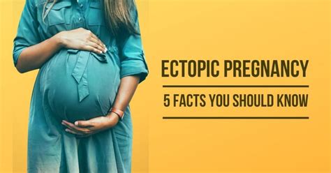 Ectopic Pregnancy 5 Facts You Should Know Sri Ramakrishna Hospital