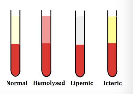 Exam Transfusion Medicine Flashcards Quizlet