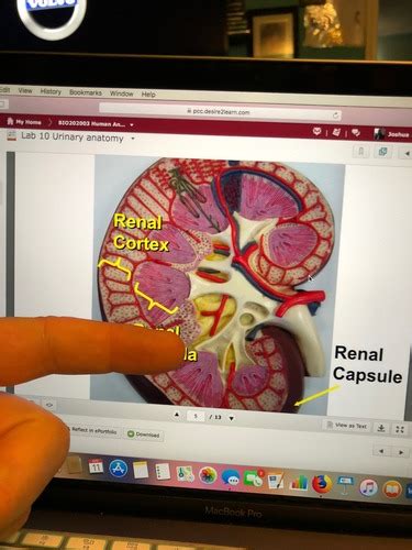 Pcc Bio 202 Lab 10 Urinary System Flashcards Quizlet