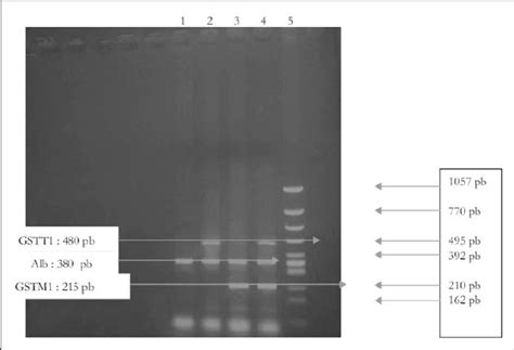 Multiplex Pcr Of Gstm And Gstt Gstm Gstt Gstm