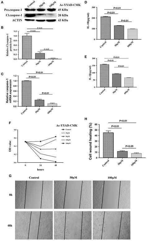 Caspase1 Inactivation Significantly Decreased The Protein Expression Of