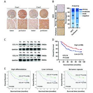 Relative Ccl Expression In Hcc Tissues And Its Clinical Significance