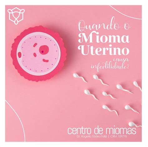 Quando O Mioma Uterino Causa Infertilidade