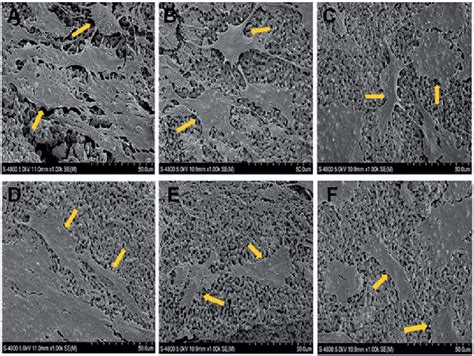 Representative Sem Images Of Cell Attachment On The D Printed Ha B Tcp