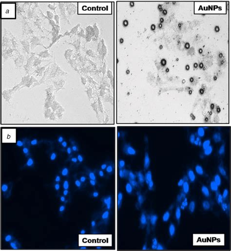 Morphological Analysis A The Morphological Changes In Hela Cells