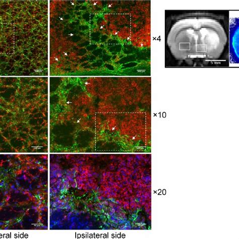 Representative Immunohistochemical Staining Of Microglial And