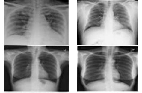 An exemplary of medical X-rays | Download Scientific Diagram