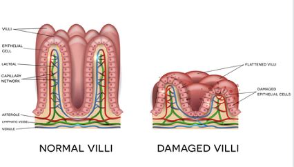 Common Pathologies Of The Digestive System Flashcards Quizlet