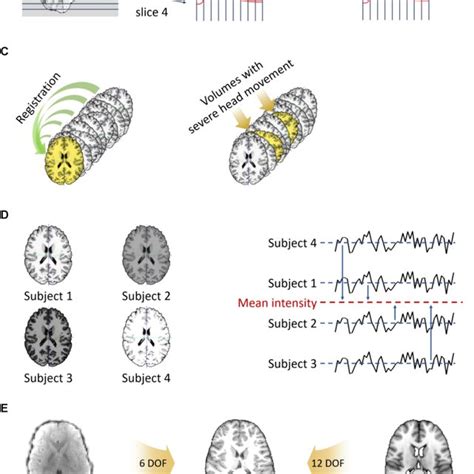 Preprocessing Steps For Volume Based FMRI Data A Removal Of The