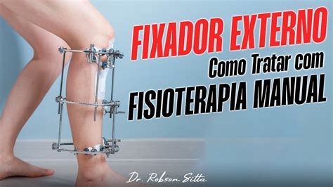 Fixador Externo De Ilizarov Tratamento De Fisioterapia Terapia