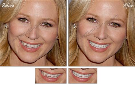 Celebrity teeth correction with photo editing. Straighten Jewel Kilcher ...