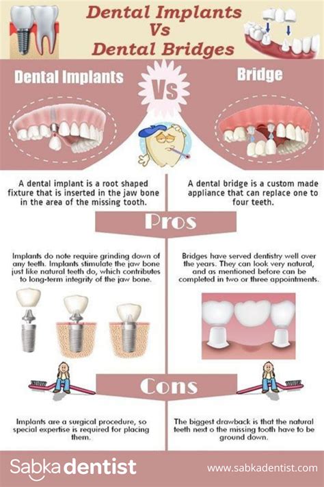 Dental Implants Vs Bridges How To Know What S Best For You Dental