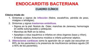 Endocarditis bacteriana a válvula nativa PPT