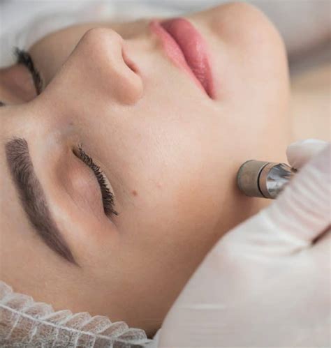 Microdermabrasion Treatments In New York Byou Laser Clinic