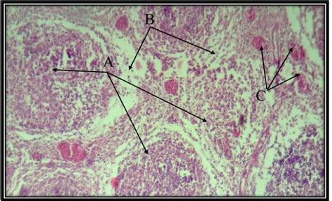 Histological section of bursa of fabricia shows follicular depletion... | Download Scientific ...