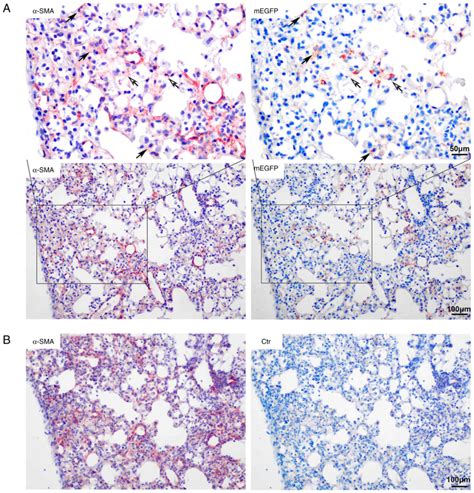 Cell Tracing Reveals The Transdifferentiation Fate Of Mouse Lung