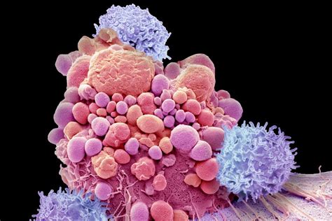 Immunothérapie les thérapies CAR T cell qui guérissent le cancer Le