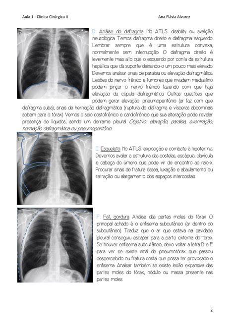 Solution Cl Nica Cir Rgica Ii Bruno Bonani Aula Avalia O Do Rx No