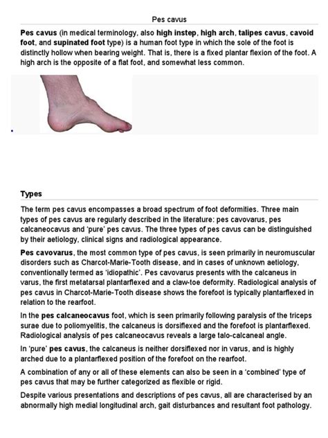 Pes cavus | Limbs (Anatomy) | Diseases And Disorders