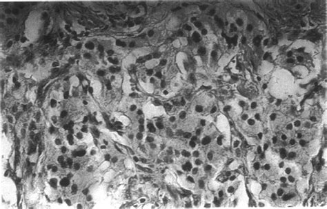 Photomicrograph of a | Download Scientific Diagram