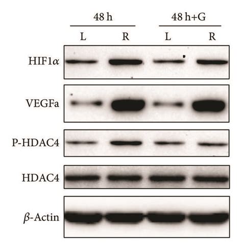 Phosphorylated HDAC4 Regulates HIF VEGF Downstream Genes Expression